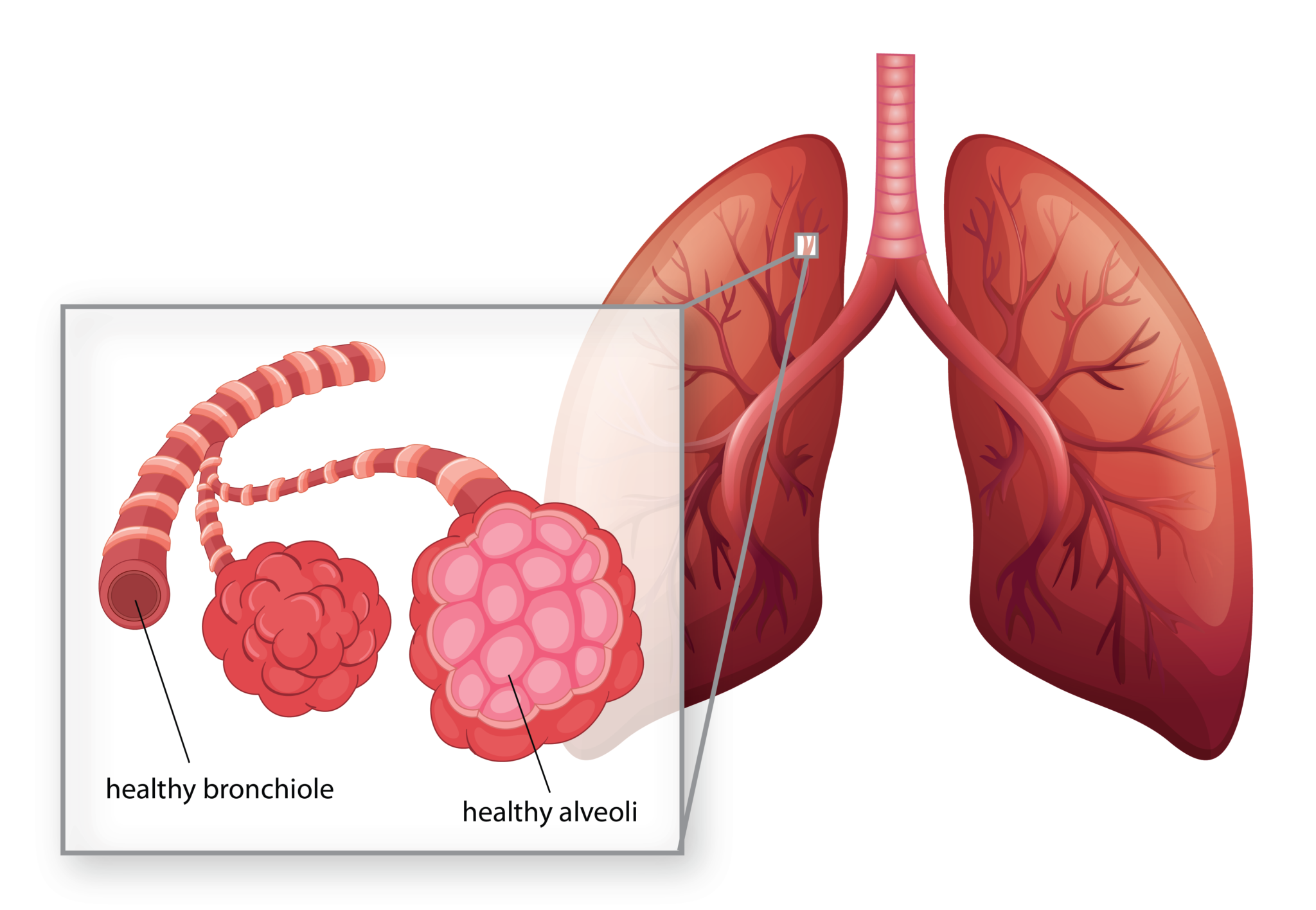 Our Technology - Respana Therapeutics